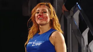 Becky Lynch, la vraie superstar de la WWE
