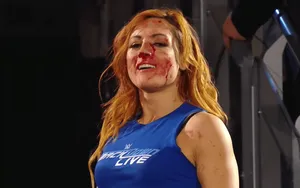 Becky Lynch, la vraie superstar de la WWE