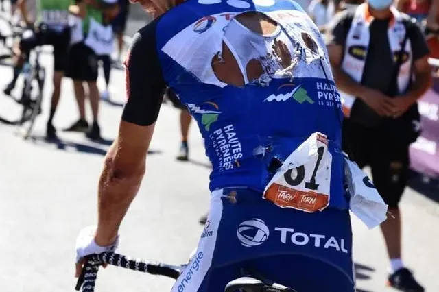 photo lilian calmejane (total direct energie) a été victime d’une nouvelle chute, à l’occasion du tour du limousin. © total direct energie