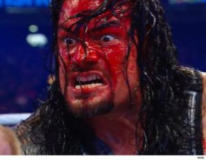 Reigns bloody face